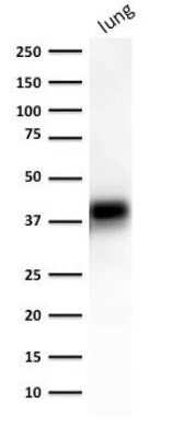 Western Blot: EpCAM/TROP1 Antibody (EGP40/1372) - (ECD) - Azide and BSA Free [NBP2-54419] - Western Blot of human lung lysate using NBP2-53264.