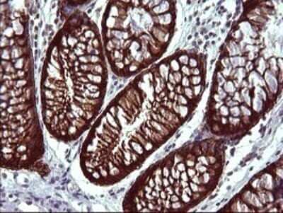 Immunohistochemistry: EpCAM/TROP1 Antibody (OTI1H9) - Azide and BSA Free [NBP2-71194] - Analysis of Human colon tissue. (Heat-induced epitope retrieval by 10mM citric buffer, pH6.0, 120C for 3min)