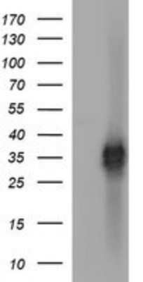 Western Blot: EpCAM/TROP1 Antibody (OTI1H9) - Azide and BSA Free [NBP2-71194] - Analysis of HEK293T cells were transfected with the pCMV6-ENTRY control (Left lane) or pCMV6-ENTRY EPCAM.