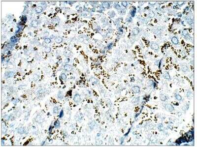 Immunohistochemistry-Paraffin: Epac2 Antibody [NBP3-12236] - Mouse Liver. 1:100 dilution in IHC blocking buffer. DAB (brown) staining and Hematoxylin QS (blue) counterstain. 40X magnification on Leica DM4000. FFPE section.