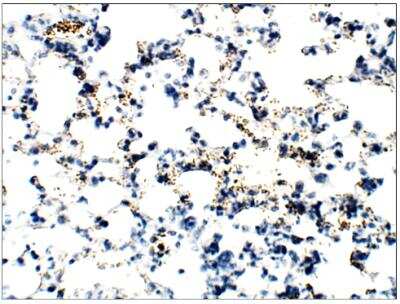 Immunohistochemistry-Paraffin: Epac2 Antibody [NBP3-12236] - Mouse Lung. 1:100 dilution in IHC blocking buffer. DAB (brown) staining and Hematoxylin QS (blue) counterstain. 40X magnification on Leica DM4000. FFPE sections.