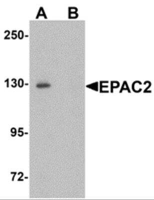 Western Blot: Epac2 Antibody [NBP2-82089] - Western blot analysis of EPAC2 in rat liver tissue lysate with EPAC2 antibody at 1 ug/mL in (A) the absence and (B) the presence of blocking peptide.