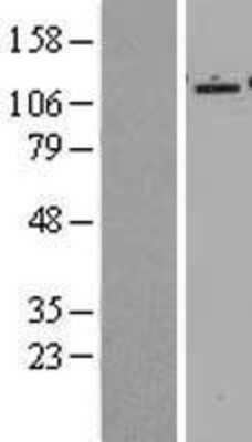 Western Blot: Epac2 Overexpression Lysate (Adult Normal) [NBL1-15153] Left-Empty vector transfected control cell lysate (HEK293 cell lysate); Right -Over-expression Lysate for Epac2.