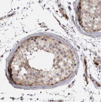 Immunohistochemistry-Paraffin EphA10 Antibody - BSA Free