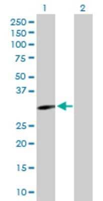 Western Blot: EphA10 Antibody [H00284656-D01P] - Analysis of EPHA10 expression in transfected 293T cell line by EPHA10 polyclonal antibody.Lane 1: EPHA10 transfected lysate(32.10 KDa).Lane 2: Non-transfected lysate.