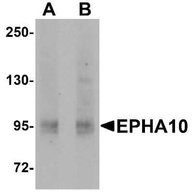 Western Blot: EphA10 Antibody [NBP1-76318] - 293 cell lysate with EphA10 antibody at (A) 1 ug/ml and (B) 2 ug/ml.