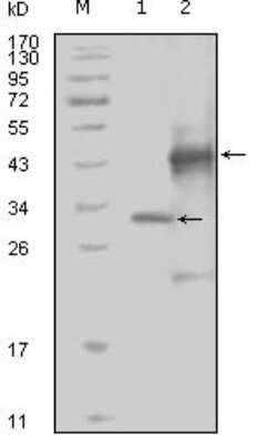 Western Blot: EphA4 Antibody (7D3D4) [NBP1-47380] - Analysis using EphA4 mouse mAb against truncated Trx-EphA4 recombinant protein (1) and truncated GST-EphA4(aa777-986) recombinant protein (2).