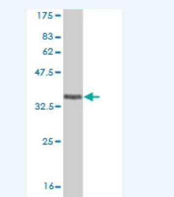 Western Blot: EphA5 Antibody (5C8) [H00002044-M04] - Detection against Immunogen (36.63 KDa) .