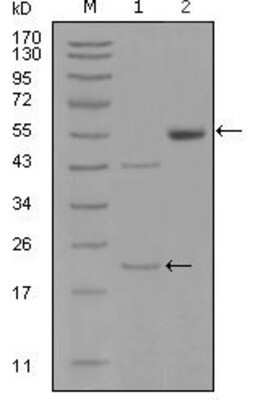 Western Blot: EphA5 Antibody (8B10B1) [NBP1-47387] - Analysis using EPHA5 mouse mAb against truncated EPHA5-His recombinant protein (1) and truncated EPHA5 (aa620-774 ) - hIgGFc transfected CHO-K1 cell lysate (2).