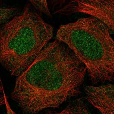 Immunocytochemistry/Immunofluorescence: EphA6 Antibody [NBP2-58343] - Staining of human cell line U-2 OS shows localization to nucleoplasm.