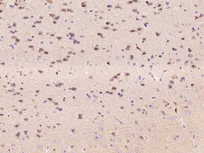 Immunohistochemistry-Paraffin: EphA6 Antibody [NBP2-98327] - Immunochemical staining of mouse EphA6 in mouse brain with rabbit polyclonal antibody at 1:1000 dilution, formalin-fixed paraffin embedded sections.