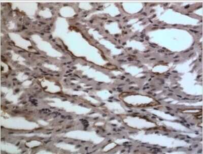 Immunohistochemistry-Paraffin: EphA7 Antibody (6E1) [NB110-93606] - The Kidney tissue samples from the Folic Acid induced kidney injury model were fixed using 4% PFA at 4C for overnight and embeded in paraffin. 4um section was sublected to IHC with NB110-93606