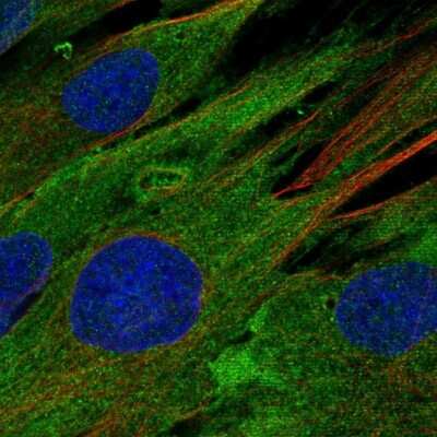 Immunocytochemistry/Immunofluorescence: EphB1 Antibody [NBP2-55594] - Staining of human cell line BJ shows localization to plasma membrane, cytosol & endoplasmic reticulum. Antibody staining is shown in green.