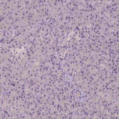 Immunohistochemistry-Paraffin: EphB1 Antibody [NBP2-55594] - Staining of human pancreas shows low expression as expected.