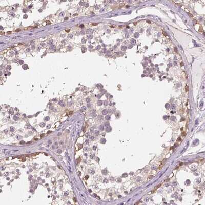 Immunohistochemistry-Paraffin: EphB1 Antibody [NBP2-55594] - Staining of human testis shows high expression.
