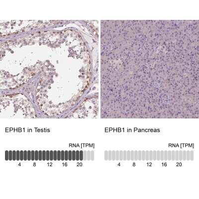 Immunohistochemistry-Paraffin: EphB1 Antibody [NBP2-55594] - Staining in human testis and pancreas tissues using anti-EPHB1 antibody. Corresponding EPHB1 RNA-seq data are presented for the same tissues.