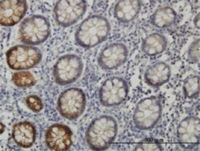 Immunohistochemistry-Paraffin: EphB3 Antibody (1B3) [H00002049-M01] - Analysis of monoclonal antibody to EPHB3 on formalin-fixed paraffin-embedded human colon. Antibody concentration 3 ug/ml.