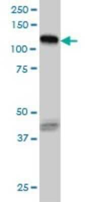 Western Blot: EphB3 Antibody (1B3) [H00002049-M01] - EPHB3 monoclonal antibody (M01), clone 1B3 Analysis of EPHB3 expression in HeLa.