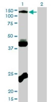 Western Blot: EphB3 Antibody (1B3) [H00002049-M01] - Analysis of EPHB3 expression in transfected 293T cell line by EPHB3 monoclonal antibody (M01), clone 1B3.Lane 1: EPHB3 transfected lysate(110.3 KDa).Lane 2: Non-transfected lysate.