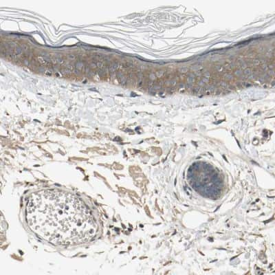 Immunohistochemistry-Paraffin: EphB3 Antibody [NBP1-84776] - Staining of human skin shows high expression.