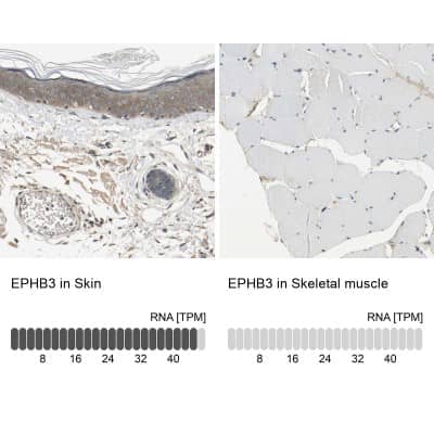 Immunohistochemistry-Paraffin: EphB3 Antibody [NBP1-84776] - Staining in human skin and skeletal muscle tissues using anti-EPHB3 antibody. Corresponding EPHB3 RNA-seq data are presented for the same tissues.