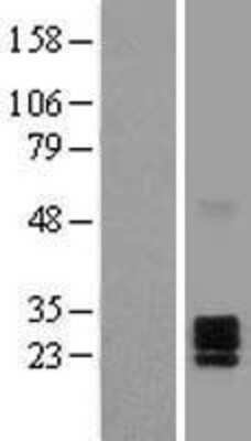 Western Blot: Ephrin A2 Overexpression Lysate (Adult Normal) [NBL1-10143] Left-Empty vector transfected control cell lysate (HEK293 cell lysate); Right -Over-expression Lysate for Ephrin A2.