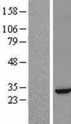 Western Blot: Ephrin A5 Overexpression Lysate (Adult Normal) [NBL1-10145] Left-Empty vector transfected control cell lysate (HEK293 cell lysate); Right -Over-expression Lysate for Ephrin A5.