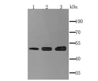 Western Blot: Ephrin-B2 Antibody (JM53-21) [NBP2-66821] - Analysis of Ephrin B2 on different tissue lysate using anti-Ephrin B2 antibody at 1/1,000 dilution. Positive control:Lane1: Human kidney Lane2: Mouse lung Lane3: Rat brain