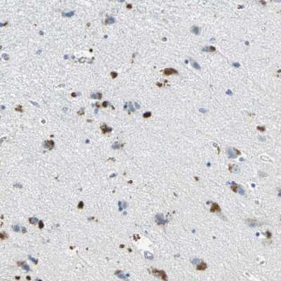 Immunohistochemistry-Paraffin: Ephrin-B3 Antibody [NBP1-84829] - Staining of human hippocampus shows strong cytoplasmic positivity in subset of neuronal cells.