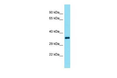 Western Blot: Ephrin-B3 Antibody [NBP3-10672] - Western blot analysis of Ephrin-B3 in Mouse Spleen lysates. Antibody dilution at 1.0ug/ml