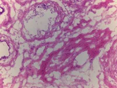 Hematoxylin & Eosin Stain: Epididymis Tissue Slides (Adult Normal) [NBP2-77542] - Tissue: Epididymus, Human, Normal