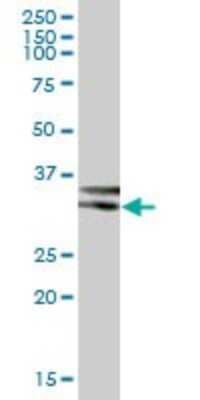 Western Blot: Epimorphin/Syntaxin 2 Antibody [H00002054-B01P] - Analysis of EPIM expression in human kidney.