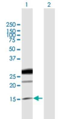 Western Blot: Epiregulin Antibody [H00002069-B01P] - Analysis of EREG expression in transfected 293T cell line by EREG polyclonal antibody.  Lane 1: EREG transfected lysate(19.00 KDa). Lane 2: Non-transfected lysate.