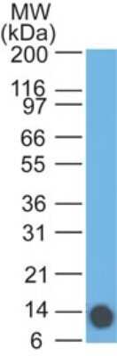 Western Blot: Eps8 Antibody (18F1F2) - Azide and BSA Free [NBP2-80723] - analysis of EPS8 partial recombinant protein using EPS8 antibody at 1 ug/ml. Image from the standard format of this antibody.