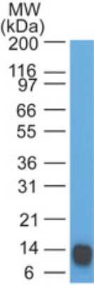 Western Blot: Eps8 Antibody (18F5B11) - Azide and BSA Free [NBP2-80724] - analysis of EPS8 partial recombinant protein using EPS8 antibody at 1 ug/ml. Image from the standard format of this antibody.