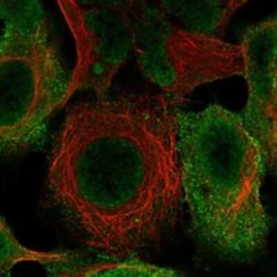 Immunocytochemistry/Immunofluorescence: Epsin 1 Antibody [NBP3-17709] - Staining of human cell line HEK 293 shows localization to plasma membrane & vesicles.