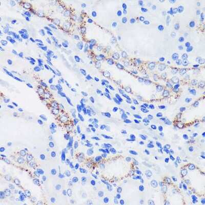 Immunohistochemistry-Paraffin: Epsin 1 Antibody [NBP3-03439] - Immunohistochemistry of paraffin-embedded Rat kidney using Epsin 1 Rabbit pAb (NBP3-03439) at dilution of 1:100 (40x lens). Perform microwave antigen retrieval with 10 mM PBS buffer pH 7.2 before commencing with IHC staining protocol.