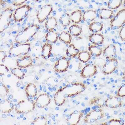 Immunohistochemistry-Paraffin: Epsin 1 Antibody [NBP3-03439] - Immunohistochemistry of paraffin-embedded Mouse kidney using Epsin 1 Rabbit pAb (NBP3-03439) at dilution of 1:100 (40x lens). Perform microwave antigen retrieval with 10 mM PBS buffer pH 7.2 before commencing with IHC staining protocol.