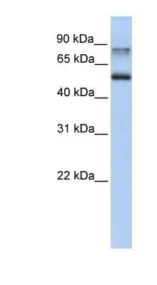 Western Blot: Epsin 1 Antibody [NBP1-56656] - Titration: 0.2-1 ug/ml, Positive Control: Human Lung.