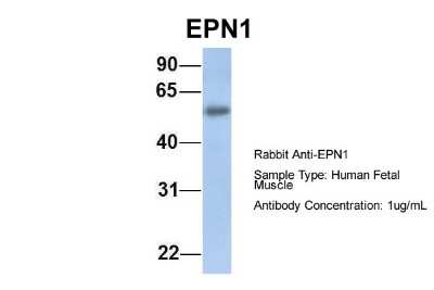 Western Blot: Epsin 1 Antibody [NBP1-56656] - Human Fetal Muscle, Antibody Dilution: 1.0 ug/ml.