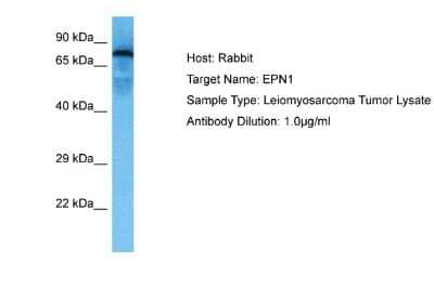 Western Blot: Epsin 1 Antibody [NBP2-87371] - Host: Rabbit. Target Name: EPN1. Sample Tissue: Human Leiomyosarcoma Tumor lysates. Antibody Dilution: 1ug/ml