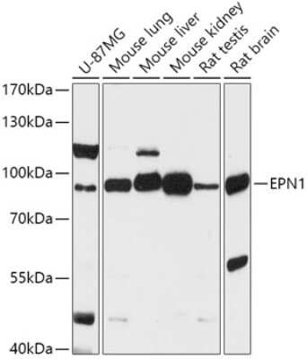 Western Blot: Epsin 1 Antibody [NBP3-03439] - Analysis of extracts of various cell lines, using Epsin 1 antibody at 1:1000 dilution. Secondary antibody: HRP Goat Anti-Rabbit IgG (H+L) at 1:10000 dilution. Lysates/proteins: 25ug per lane. Blocking buffer: 3% nonfat dry milk in TBST. Detection: ECL Basic Kit.