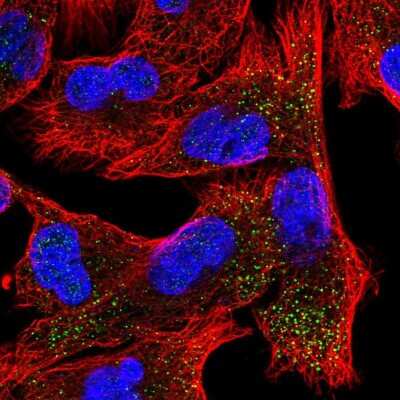 Immunocytochemistry/Immunofluorescence: Epsin-2 Antibody [NBP2-58740] - Staining of human cell line A549 shows localization to vesicles.