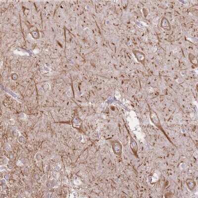 Immunohistochemistry-Paraffin: Epsin-2 Antibody [NBP2-13965] - Staining of human hippocampus shows moderate cytoplasmic positivity in neuronal cells.