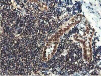 Immunohistochemistry: Epsin-2 Antibody (OTI1G3) - Azide and BSA Free [NBP2-71701] - Staining of paraffin-embedded Human tonsil using anti-Epsin-2 mouse monoclonal antibody.