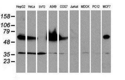 Western Blot: Epsin-2 Antibody (OTI1G3) - Azide and BSA Free [NBP2-71701] - Analysis of extracts (35ug) from 9 different cell lines by using anti-Epsin-2 monoclonal antibody.