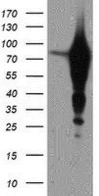 Western Blot: Epsin-2 Antibody (OTI1G3) - Azide and BSA Free [NBP2-71701] - HEK293T cells were transfected with the pCMV6-ENTRY control (Left lane) or pCMV6-ENTRY Epsin-2 (Right lane) cDNA for 48 hrs and lysed. Equivalent amounts of cell lysates (5 ug per lane) were separated by SDS-PAGE and immunoblotted with anti-Epsin-2.