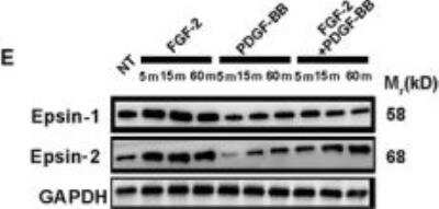 Western Blot: Epsin-2 Antibody [NBP2-16359] - Time course analysis of epsin-1 and epsin-2 protein levels in FGF-2-, PDGF-BB- or FGF-2 + PDGF-BB-stimulated pericytes (n = 3 samples/group). Image collected and cropped by CiteAb from the following publication (onlinelibrary.wiley.com/doi/abs/10.1111/jcmm.14850), licensed under a CC-BY license.