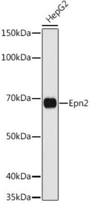 Western Blot: Epsin-2 Antibody [NBP3-02942] - Western blot analysis of extracts of HepG2 cells, using Epsin-2 antibody (NBP3-02942) at 1:1000 dilution. Secondary antibody: HRP Goat Anti-Rabbit IgG (H+L) at 1:10000 dilution. Lysates/proteins: 25ug per lane. Blocking buffer: 3% nonfat dry milk in TBST. Detection: ECL Basic Kit. Exposure time: 90s.