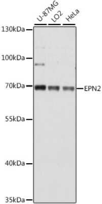 Western Blot: Epsin-2 Antibody [NBP3-03347] - Analysis of extracts of various cell lines, using Epsin-2 antibody at 1:1000 dilution. Secondary antibody: HRP Goat Anti-Rabbit IgG (H+L) at 1:10000 dilution. Lysates/proteins: 25ug per lane. Blocking buffer: 3% nonfat dry milk in TBST. Detection: ECL Basic Kit.